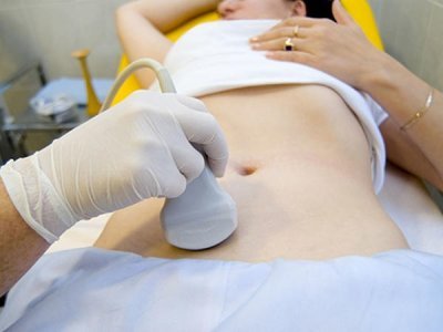 Yumurtalıq kistləri nədir? Necə yaranır? Necə müalicə edilir?